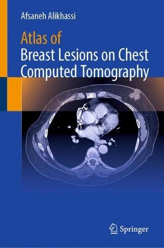Atlas of Breast Lesions on Chest Computed Tomography