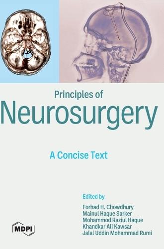Principles of Neurosurgery: A Concise Text