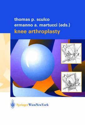 Knee Arthroplasty