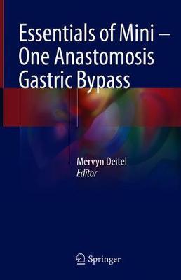 Essentials of Mini ‒ One Anastomosis Gastric Bypass