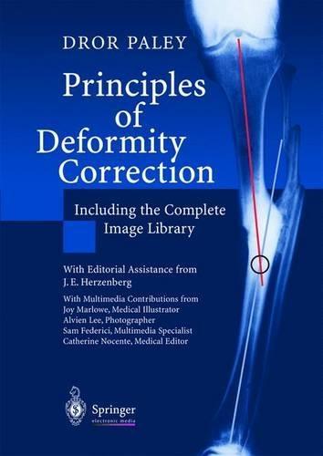 Principles of Deformity Correction: Including the Complete Image Library