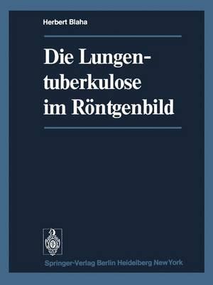 Die Lungentuberkulose Im Rontgenbild