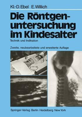 Die Rontgenuntersuchung Im Kindesalter: Technik Und Indikation