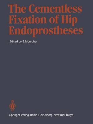 The Cementless Fixation of Hip Endoprostheses