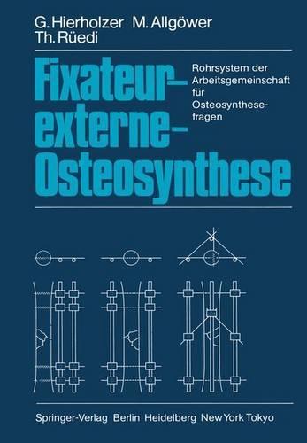 Fixateur-Externe-Osteosynthese: Rohrsystem Der Arbeitsgemeinschaft Fur Osteosynthesefragen