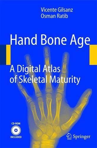 Hand Bone Age: A Digital Atlas of Skeletal Maturity