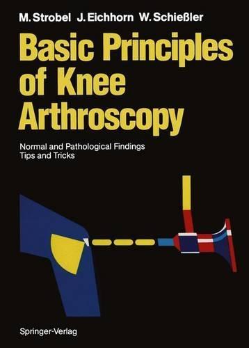 Basic Principles of Knee Arthroscopy: Normal and Pathological Findings - Tips and Tricks
