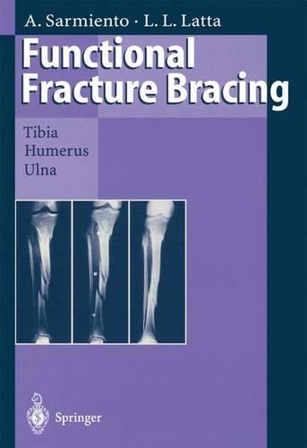 Functional Fracture Bracing: Tibia, Humerus, and Ulna