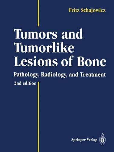 Tumors and Tumorlike Lesions of Bone: Pathology, Radiology and Treatment
