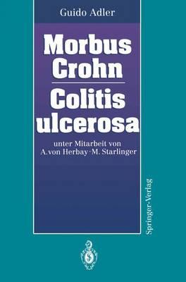 Morbus Crohn - Colitis Ulcerosa