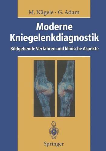 Moderne Kniegelenkdiagnostik: Bildgebende Verfahren Und Klinische Aspekte