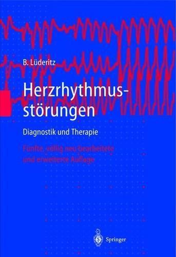 Herzrhythmusstarungen: Diagnostik Und Therapie
