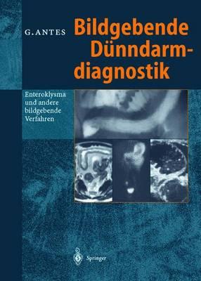 Bildgebende Da1/4nndarmdiagnostik: Enteroklysma Und Andere Bildgebende Verfahren