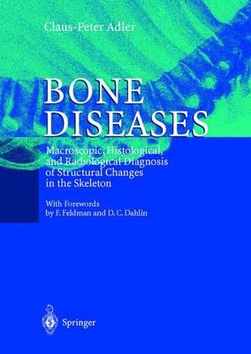 Bone Diseases: Macroscopic, Histological, and Radiological Diagnosis of Structural Changes in the Skeleton
