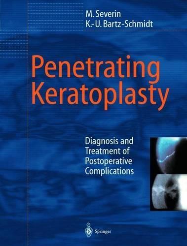 Penetrating Keratoplasty: Diagnosis and Treatment of Postoperative Complications