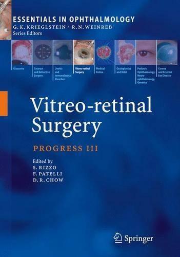 Vitreo-Retinal Surgery