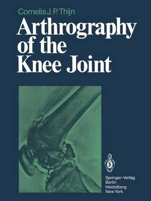 Arthrography of the Knee Joint
