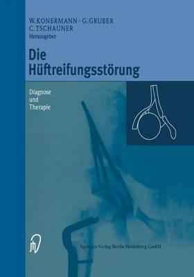 Die Hüftreifungsstörung: Diagnose und Therapie