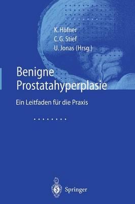 Benigne Prostatahyperplasie: Leitfaden für die Praxis