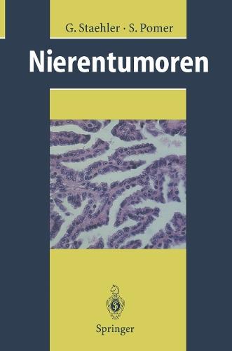 Nierentumoren: Grundlagen, Diagnostik, Therapie