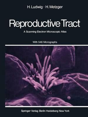 The Human Female Reproductive Tract: A Scanning Electron Microscopic Atlas