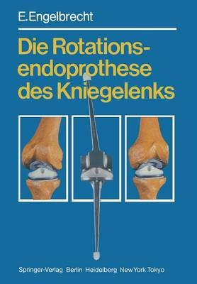 Die Rotationsendoprothese des Kniegelenks