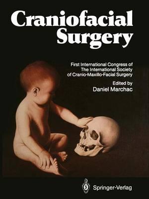 Craniofacial Surgery: Proceedings of the First International Congress of The International Society of Cranio-Maxillo-Facial Surgery. President: Paul Tessier. Cannes-La Napoule, 1985