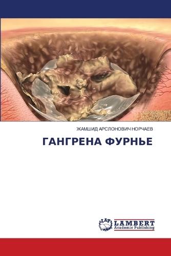 ГАНГРЕНА ФУРНЬЕ