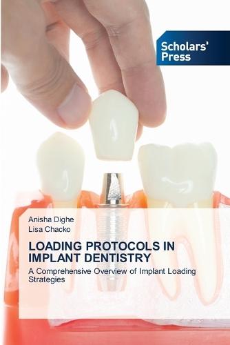 Loading Protocols in Implant Dentistry