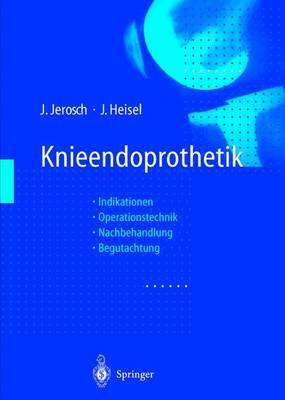 Knieendoprothetik: Indikationen - Operationstechnik Nachbehandlung - Begutachtung
