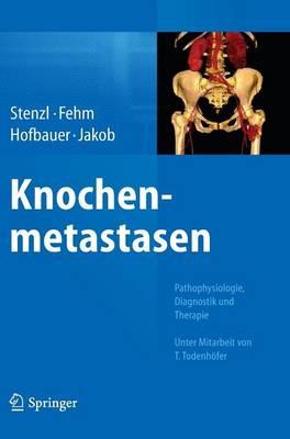 Knochenmetastasen: Pathophysiologie, Diagnostik und Therapie - Unter Mitarbeit von T. Todenhöfer