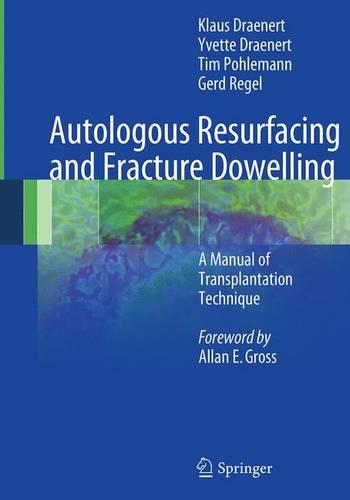Autologous Resurfacing and Fracture Dowelling: A Manual of Transplantation Technique