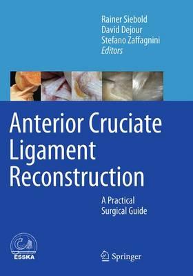 Anterior Cruciate Ligament Reconstruction: A Practical Surgical Guide