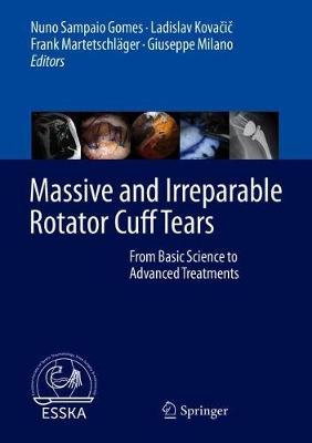Massive and Irreparable Rotator Cuff Tears: From Basic Science to Advanced Treatments