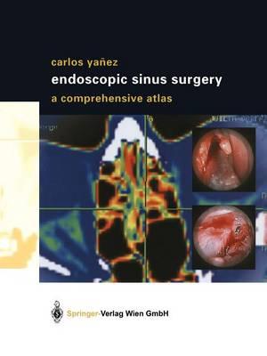 Endoscopic Sinus Surgery: A Comprehensive Atlas