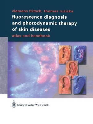 Fluorescence Diagnosis and Photodynamic Therapy of Skin Diseases: Atlas and Handbook