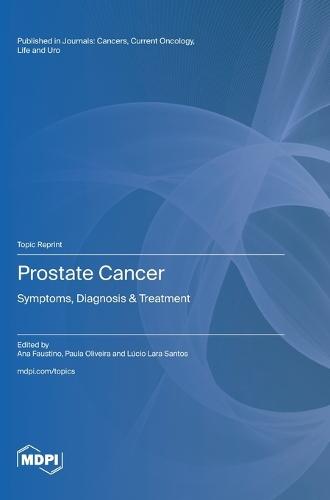 Prostate Cancer: Symptoms, Diagnosis & Treatment