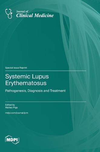 Systemic Lupus Erythematosus: Pathogenesis, Diagnosis and Treatment