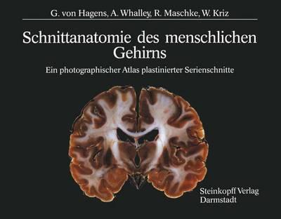Schnittanatomie Des Menschlichen Gehirns: Ein Photographischer Atlas Plastinierter Serienschnitte