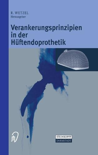 Verankerungsprinzipien in Der Ha1/4ftendoprothetik