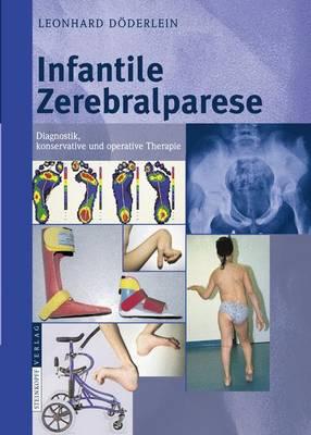Die Infantilen Zerebralparesen: Grundlagen Konservativer Und Operativer Therapie
