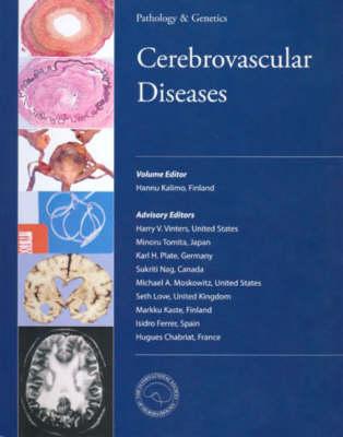 Cerebrovascular Diseases
