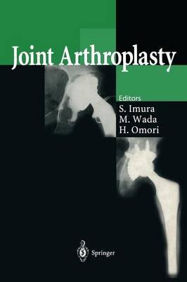 Joint Arthroplasty