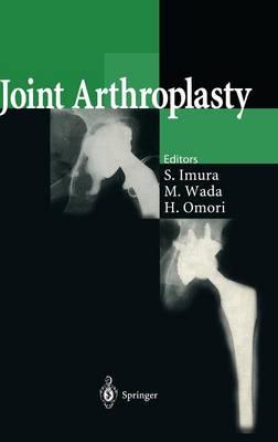 Joint Arthroplasty