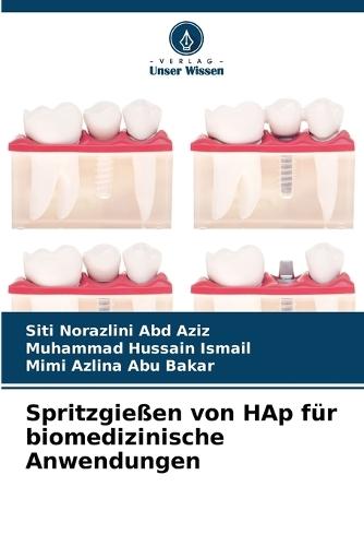 Spritzgießen von HAp für biomedizinische Anwendungen
