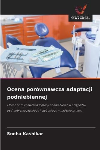 Ocena porównawcza adaptacji podniebiennej