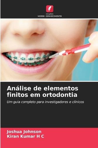 Análise de elementos finitos em ortodontia