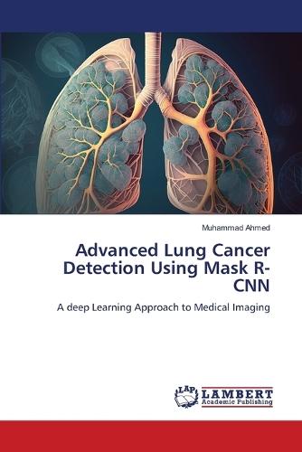 Advanced Lung Cancer Detection Using Mask R-CNN