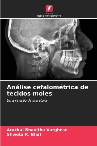 Análise cefalométrica de tecidos moles