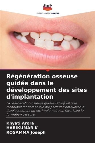 Régénération osseuse guidée dans le développement des sites d'implantation